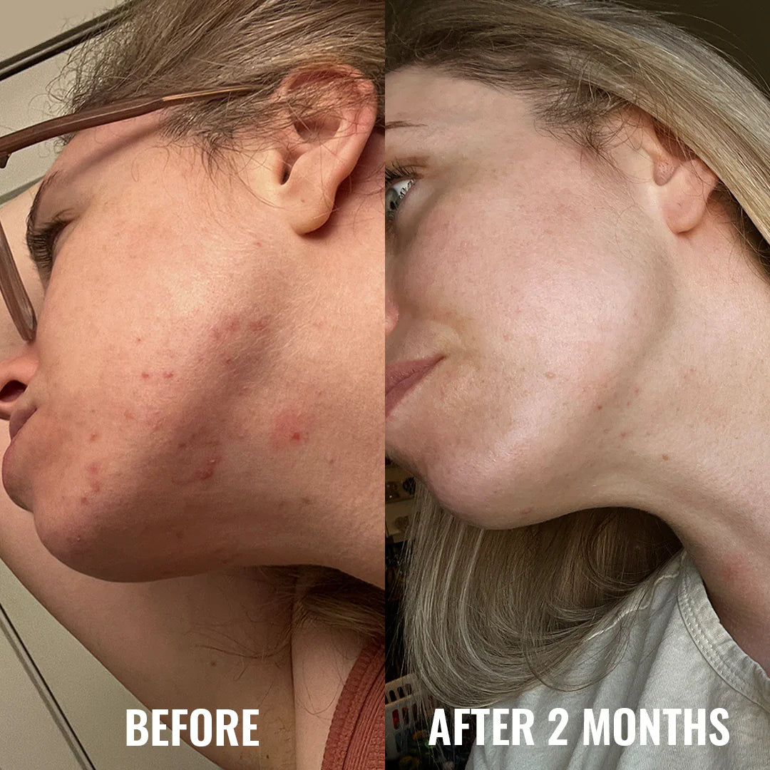 Discoloration Correcting Serum - 30ml