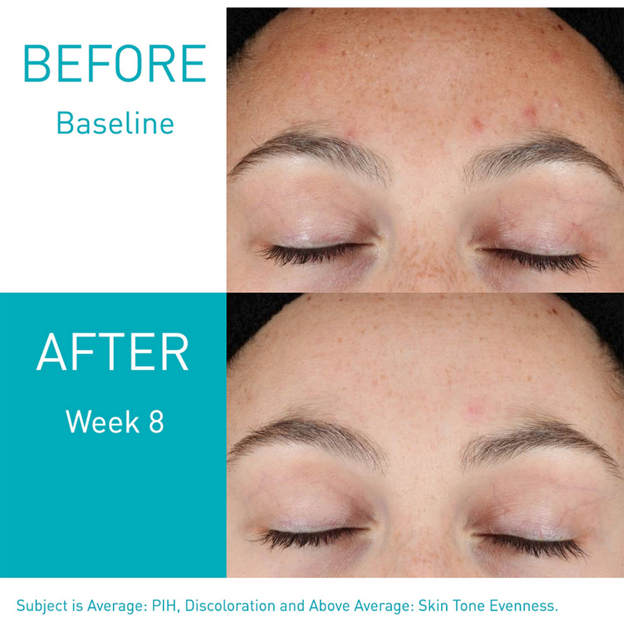 CeraVe® Resurfacing Retinol Serum - 30ml
