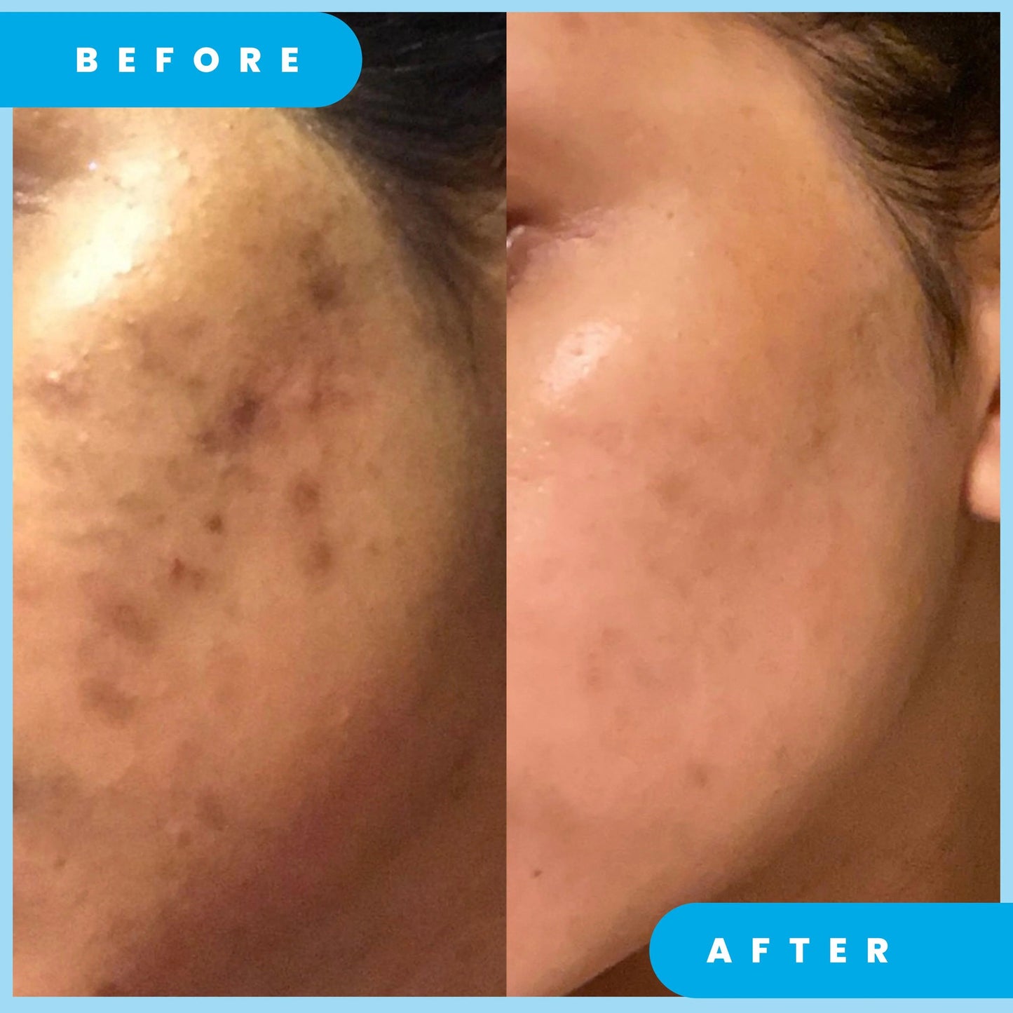 Admire My skin Ultra-Potent Brightening Serum - 30ml