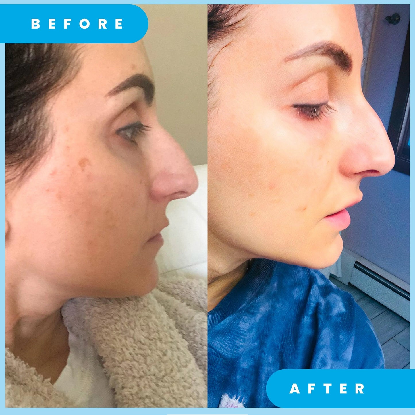 Admire My skin Ultra-Potent Brightening Serum - 30ml