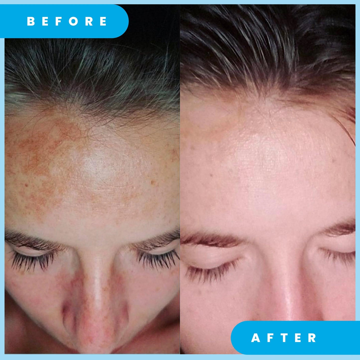 Admire My skin Ultra-Potent Brightening Serum - 30ml