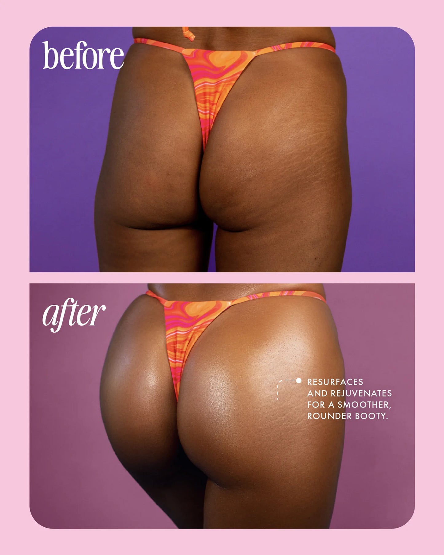BUNS OF GLOWRY Tighten & Glow Smoothing Butt Butter - 60ml