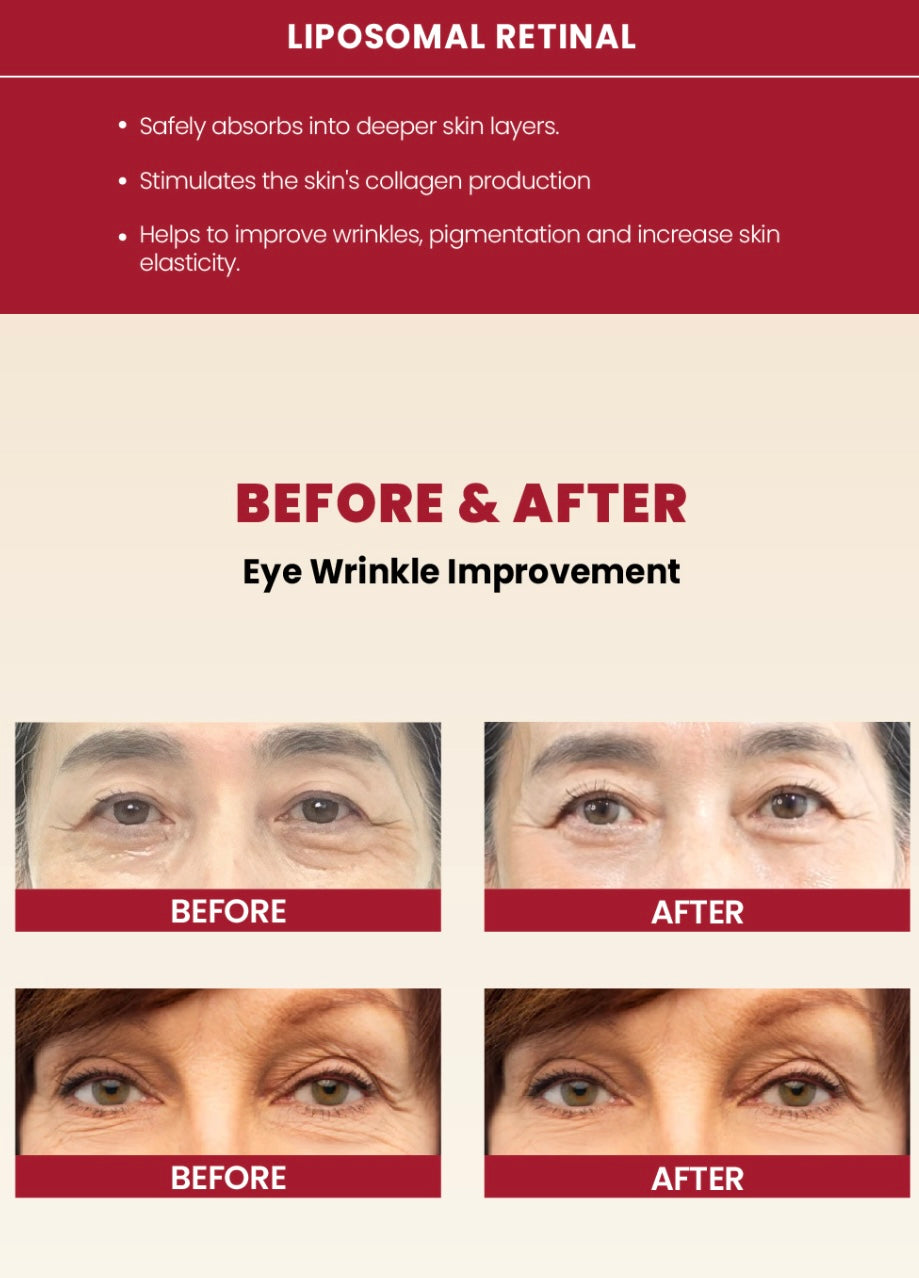 K-SECRET Seoul 1988 Eye Cream : RETINAL LIPOSOME 4% + FERMENTED BEAN -