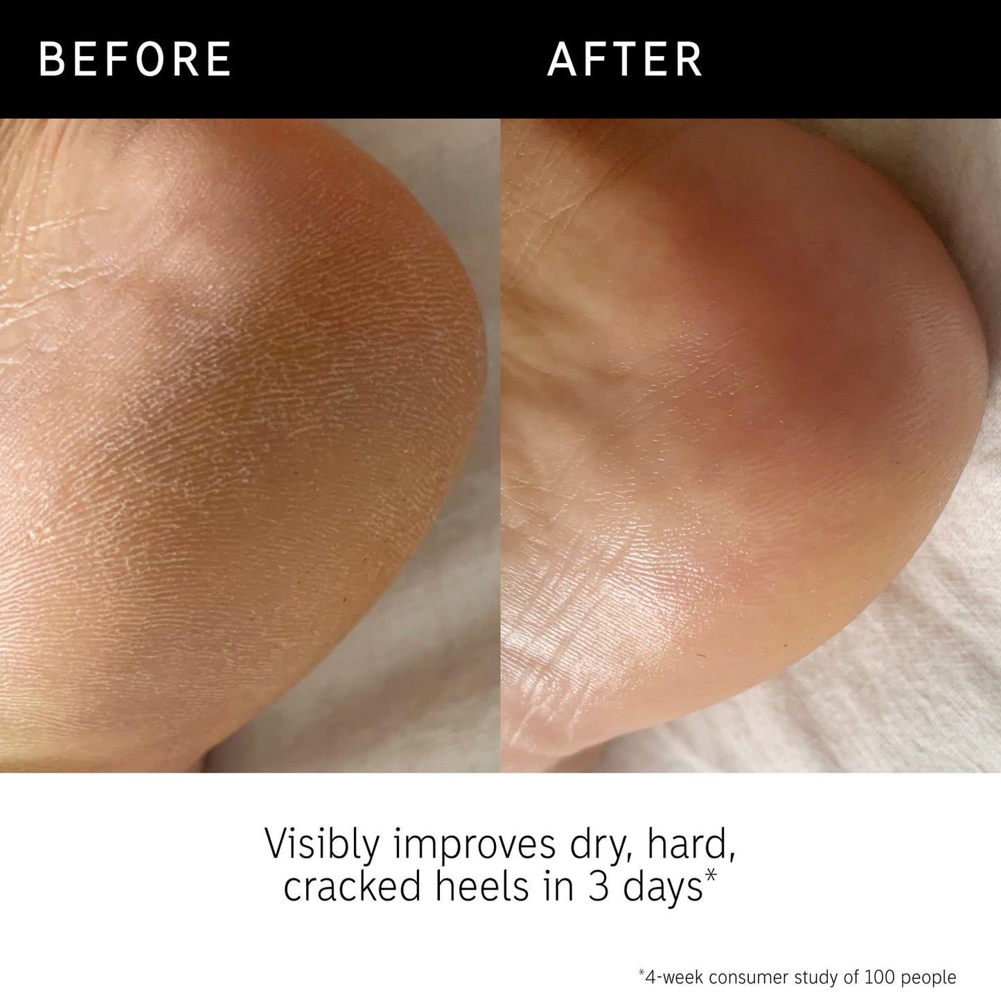 THE INKEY LIST Glycolic Acid Exfoliating Body Stick - 45g