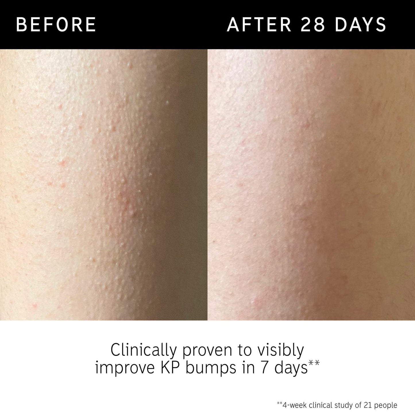 THE INKEY LIST Glycolic Acid Exfoliating Body Stick - 45g