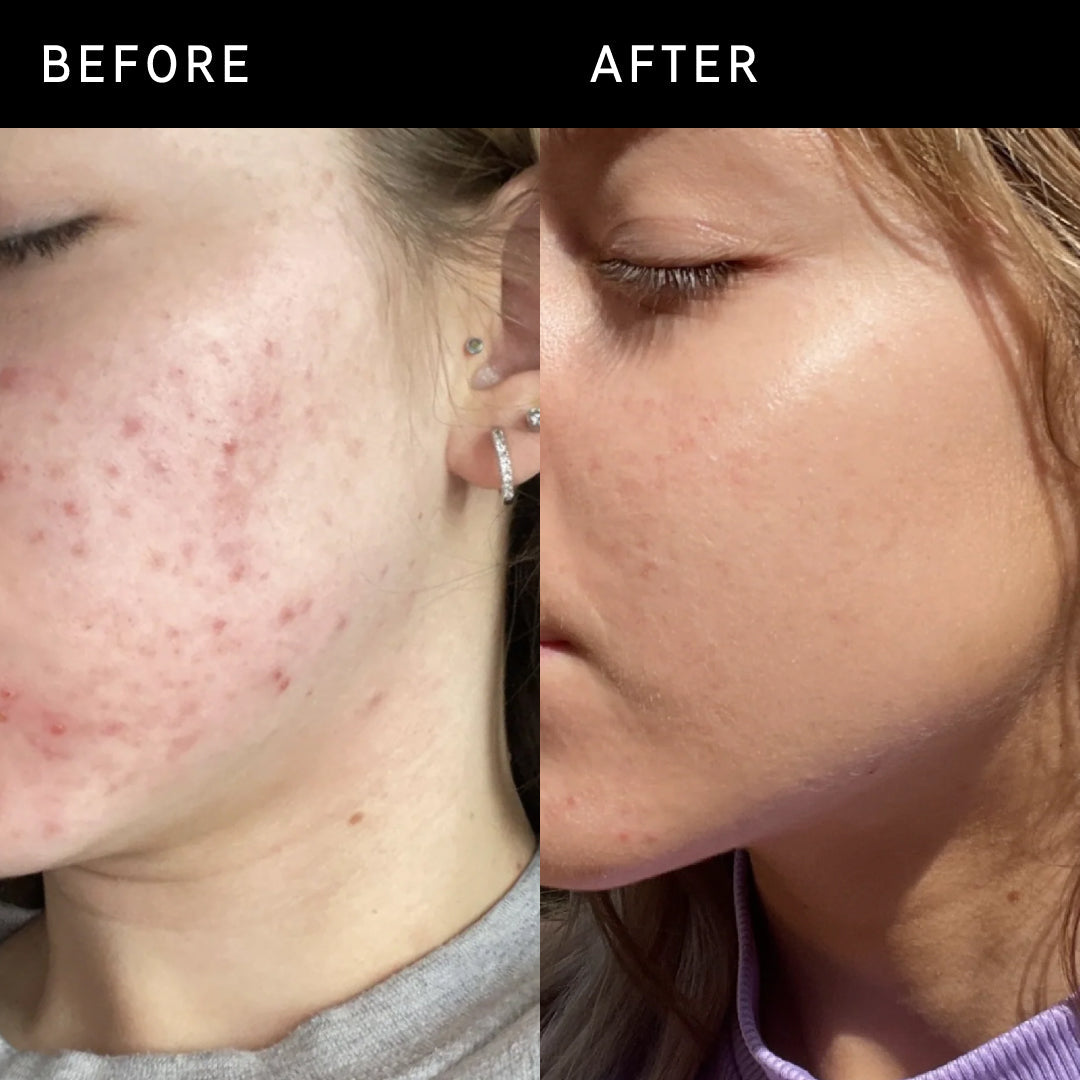 THE INKEY LIST Niacinamide Serum - 30ml