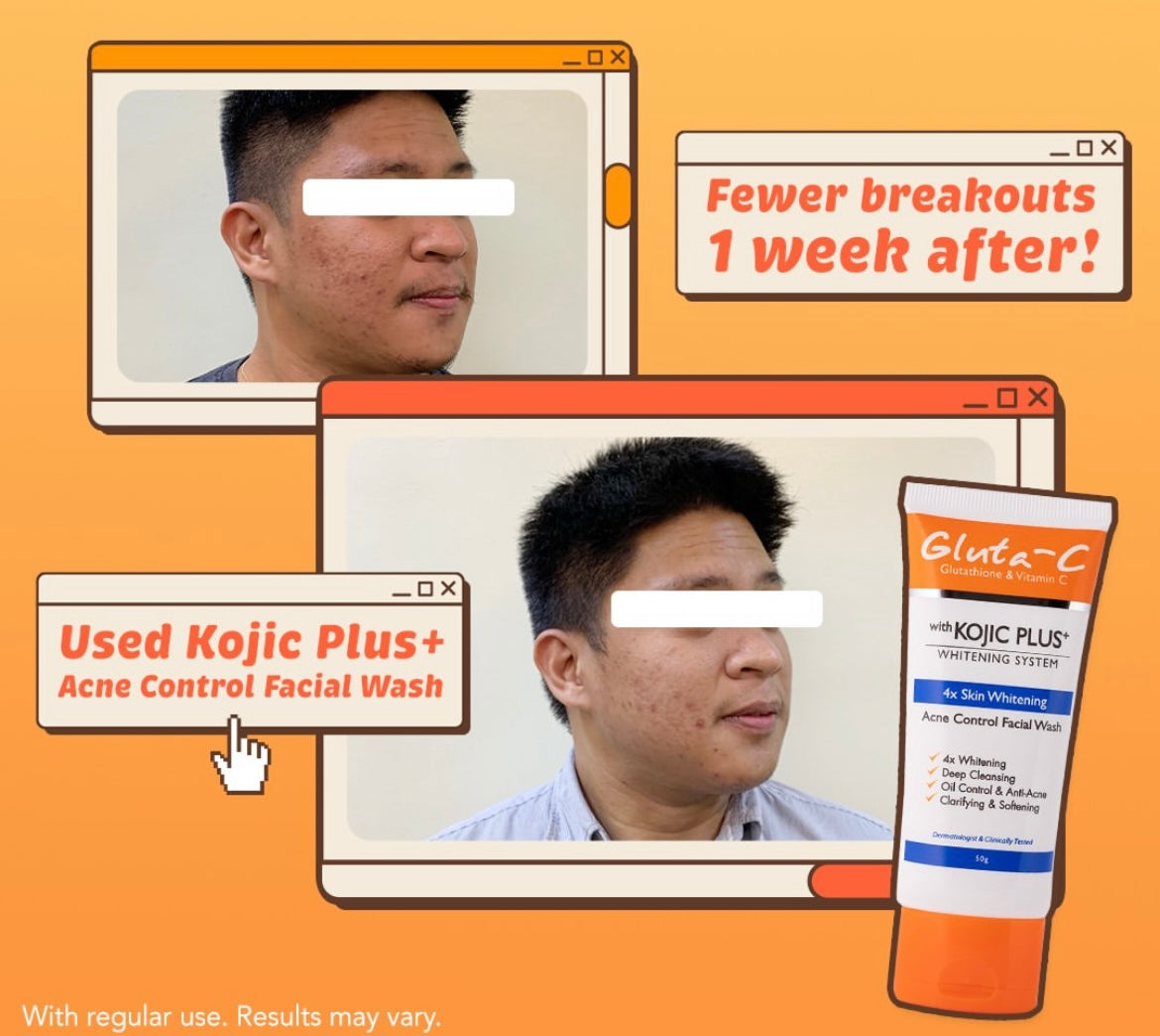 Gluta-C Kojic Plus Acne Control Facial Wash - 50g