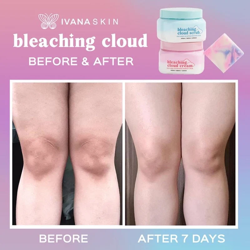 Ivana Skin Bleaching Cloud Scrub