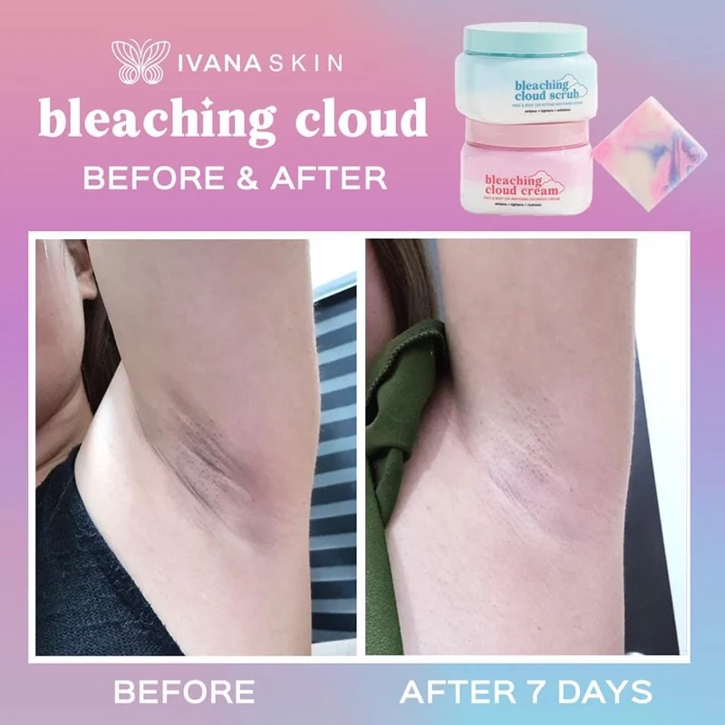 Ivana Skin Bleaching Cloud Scrub
