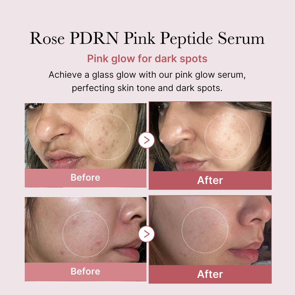 Medicube PDRN Pink Peptide Serum - 30ml