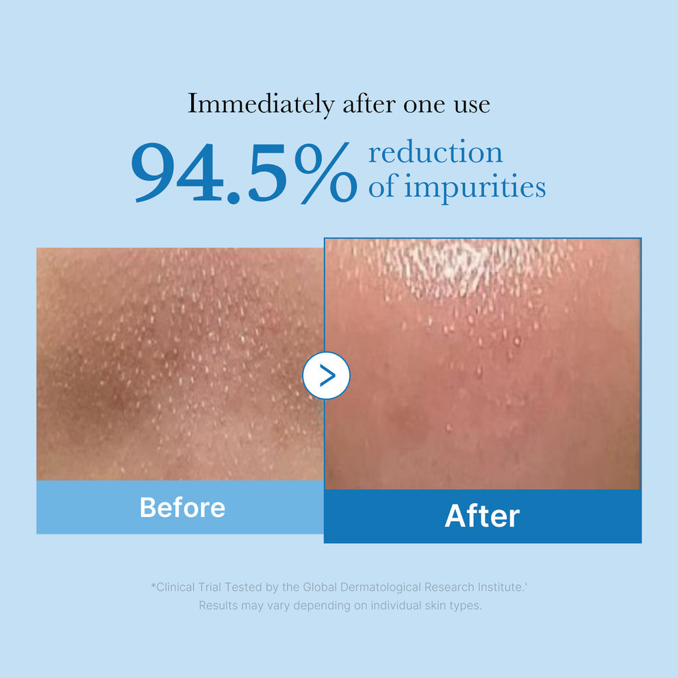 Medicube Zero Pore Blackhead Deep Cleansing Oil - 205ml