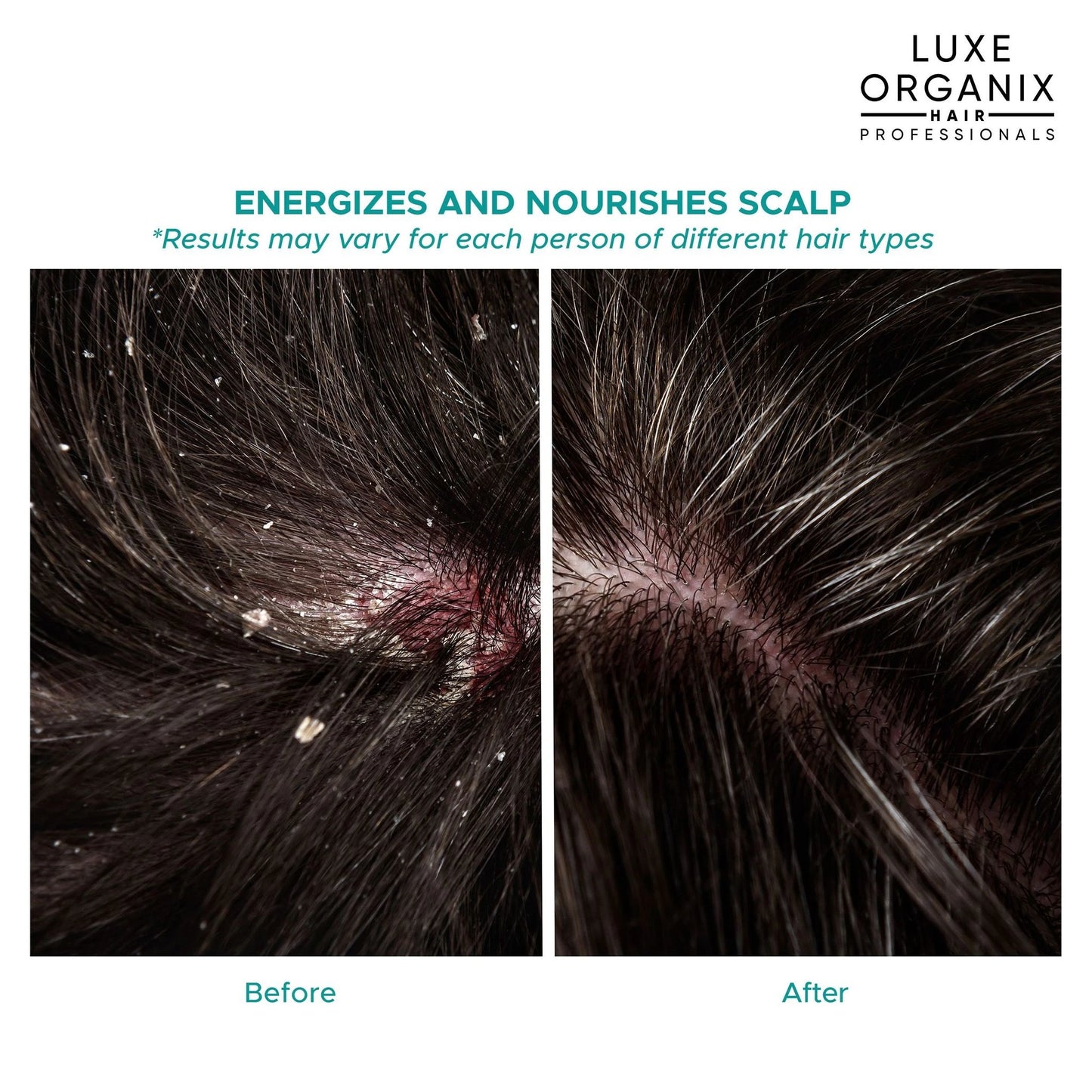 LUXE ORGANIX Scalp Therapy Anti-Hairfall Strengthening Conditioner - 250ml