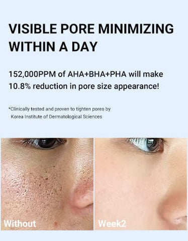 MEDICUBE Zero Pore One Day Serum - 30ml