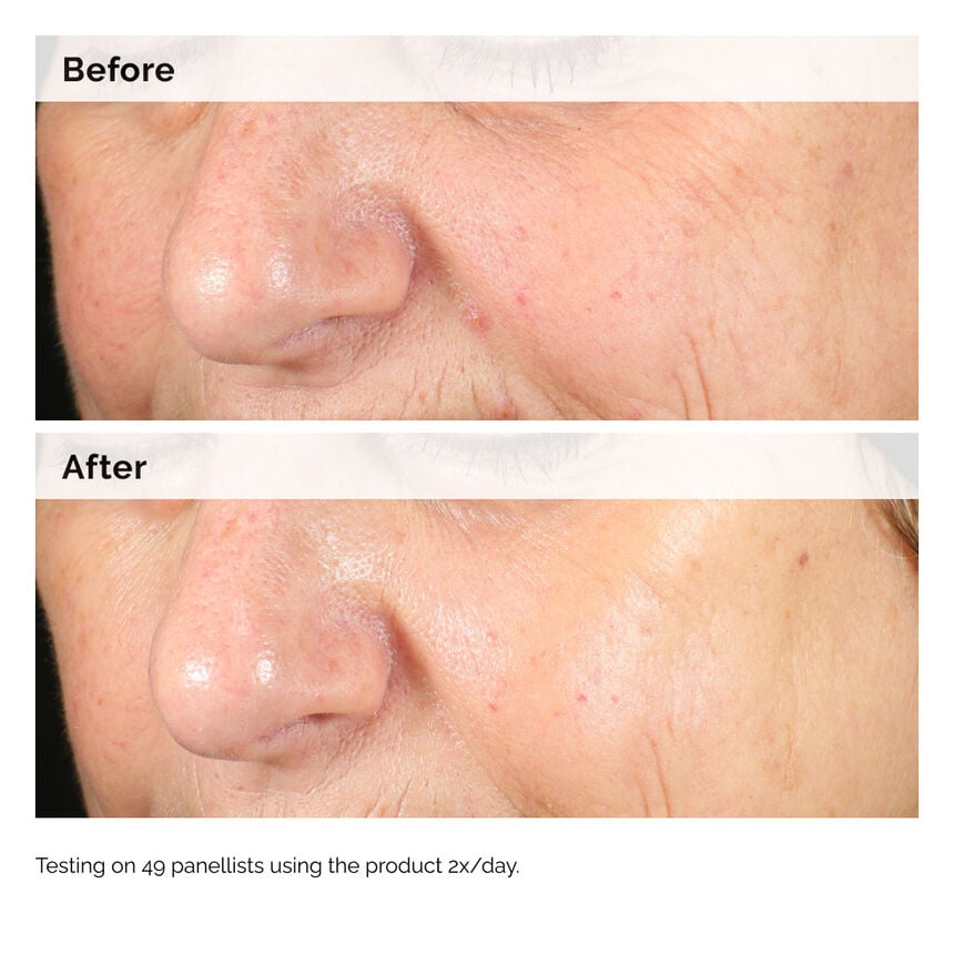 The Ordinary Alpha Arbutin 2% + HA - 30ml