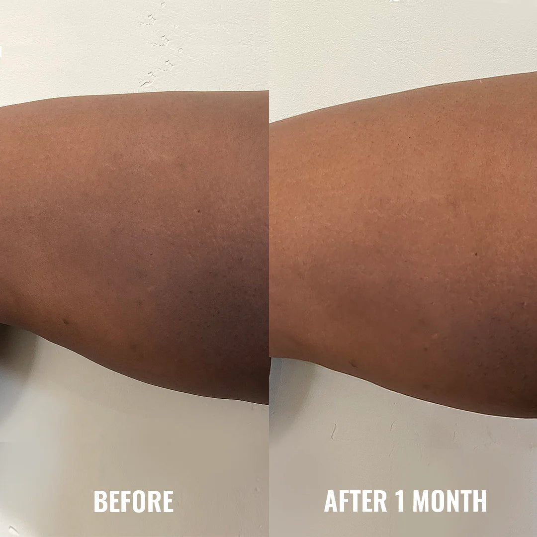 Discoloration Correcting Body Treatment - 120ml