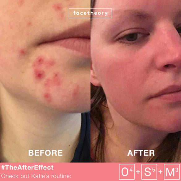 Centasoothe Serum - 30ml