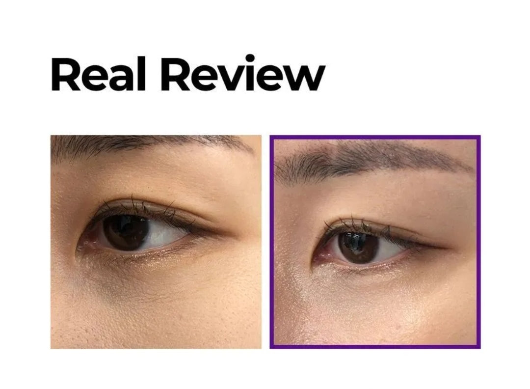 Retinol Intense Advanced Triple Action Eye Cream - 30ml