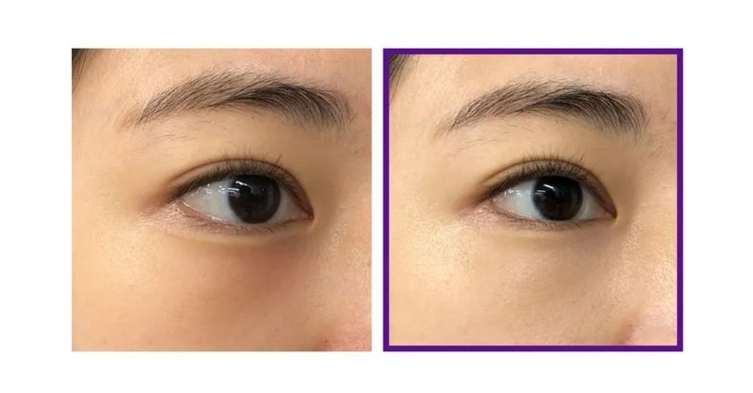 Retinol Intense Advanced Triple Action Eye Cream - 30ml
