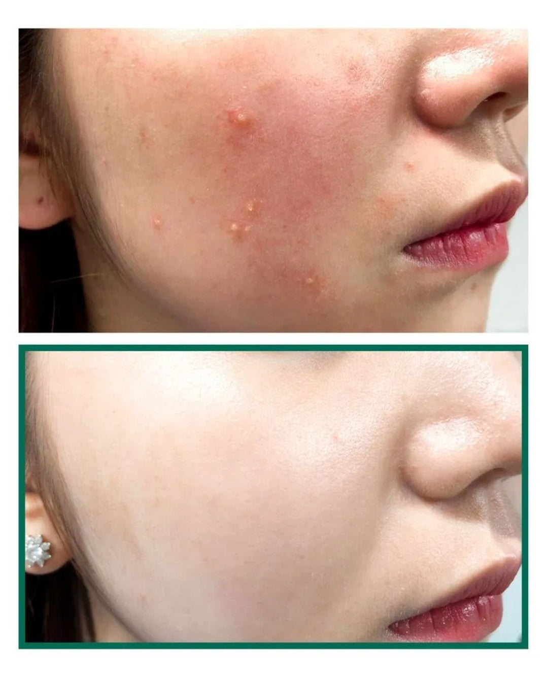AHA BHA PHA 30 DAYS MIRACLE TRUECICA CLEAR PADS
