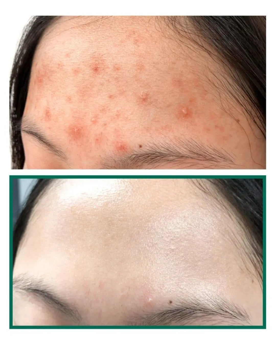 AHA BHA PHA 30 DAYS MIRACLE TRUECICA CLEAR PADS
