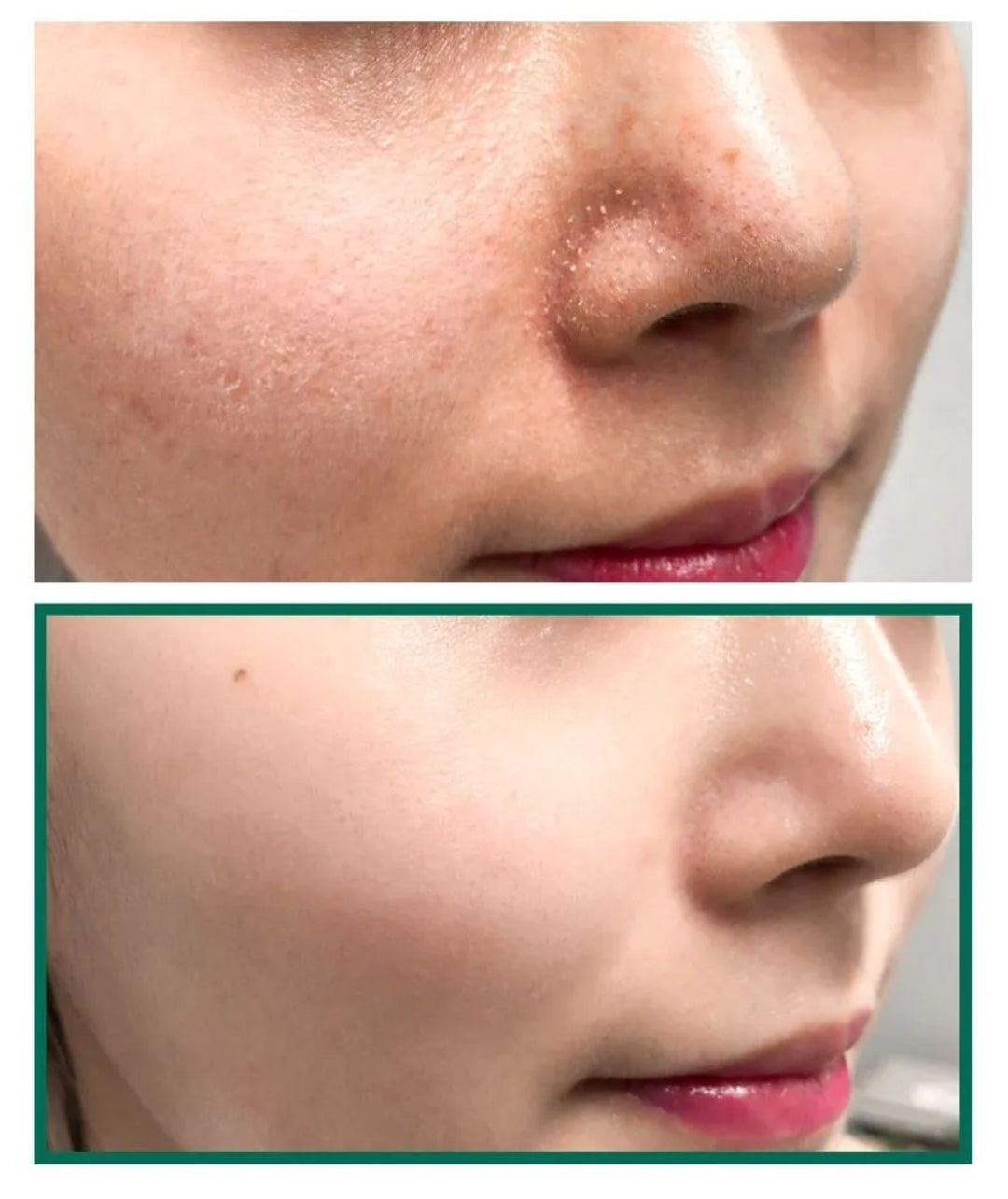AHA BHA PHA 30 DAYS MIRACLE TRUECICA CLEAR PADS