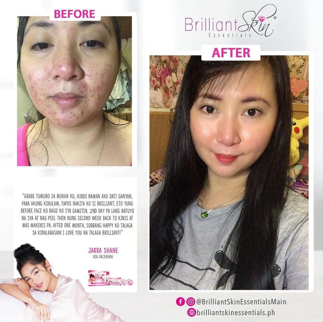 Brilliant Skin Rejuvenating Whitening Kit