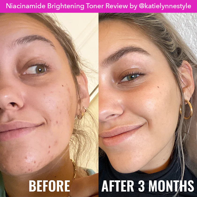 Niacinamide Brightening Toner - 120ml