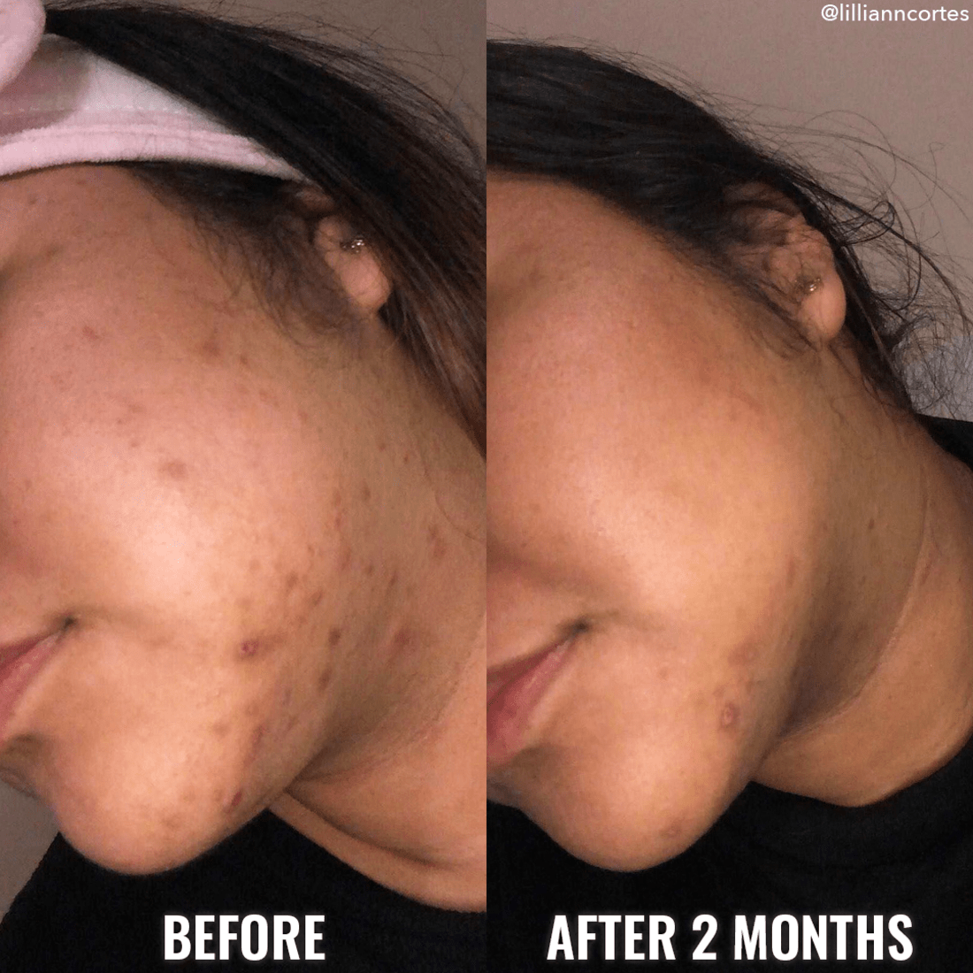 Discoloration Correcting Serum - 30ml