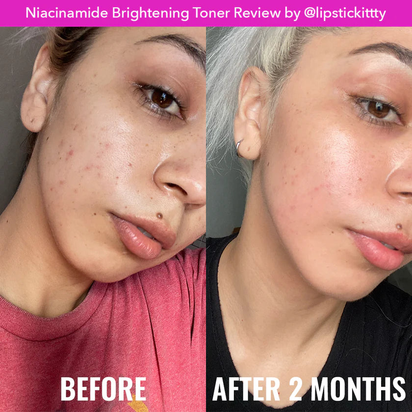 Niacinamide Brightening Toner - 120ml