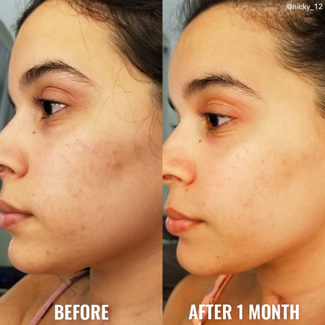 Glycolic Exfoliating Toner - 120ml