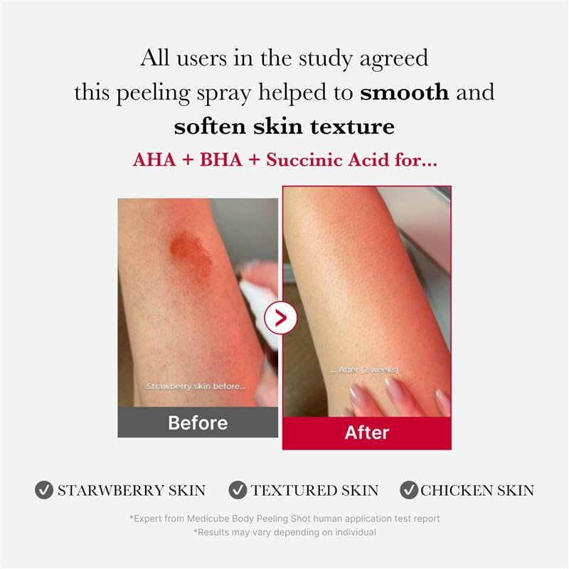 MEDICUBE Red Acne Body Peeling Shot - 110g