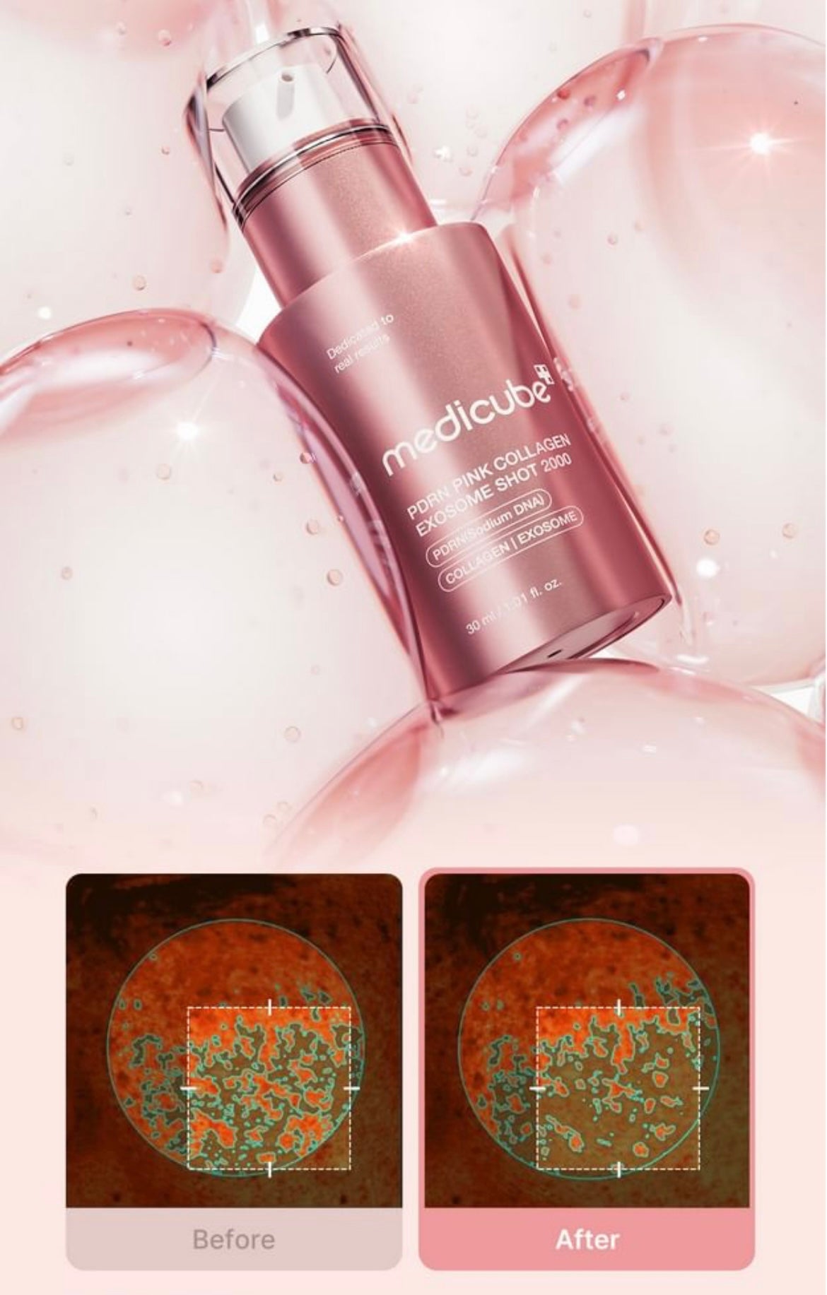 MEDICUBE PDRN Pink Exosome Shot Serum 2000PPM - 30ml