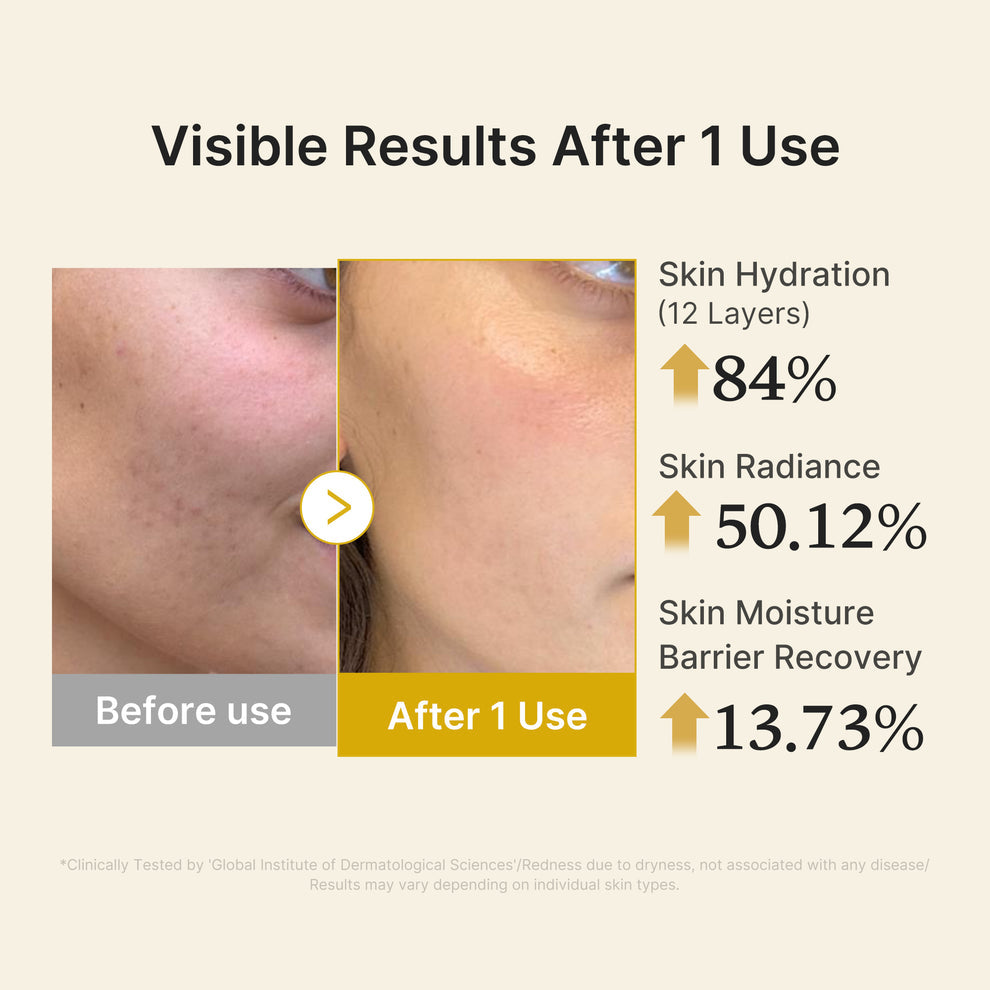 MEDICUBE Kojic Acid Turmeric Vita Jelly Mist Serum - 100ml
