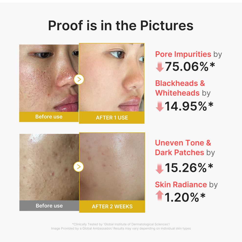 MEDICUBE Kojic Acid Turmeric Peel Shot - 80ml
