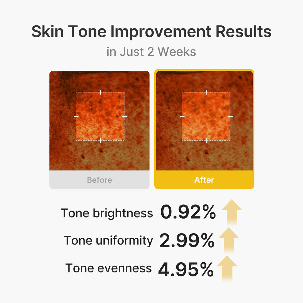 MEDICUBE Kojic Acid Turmeric Vita Capsule Cream - 53g