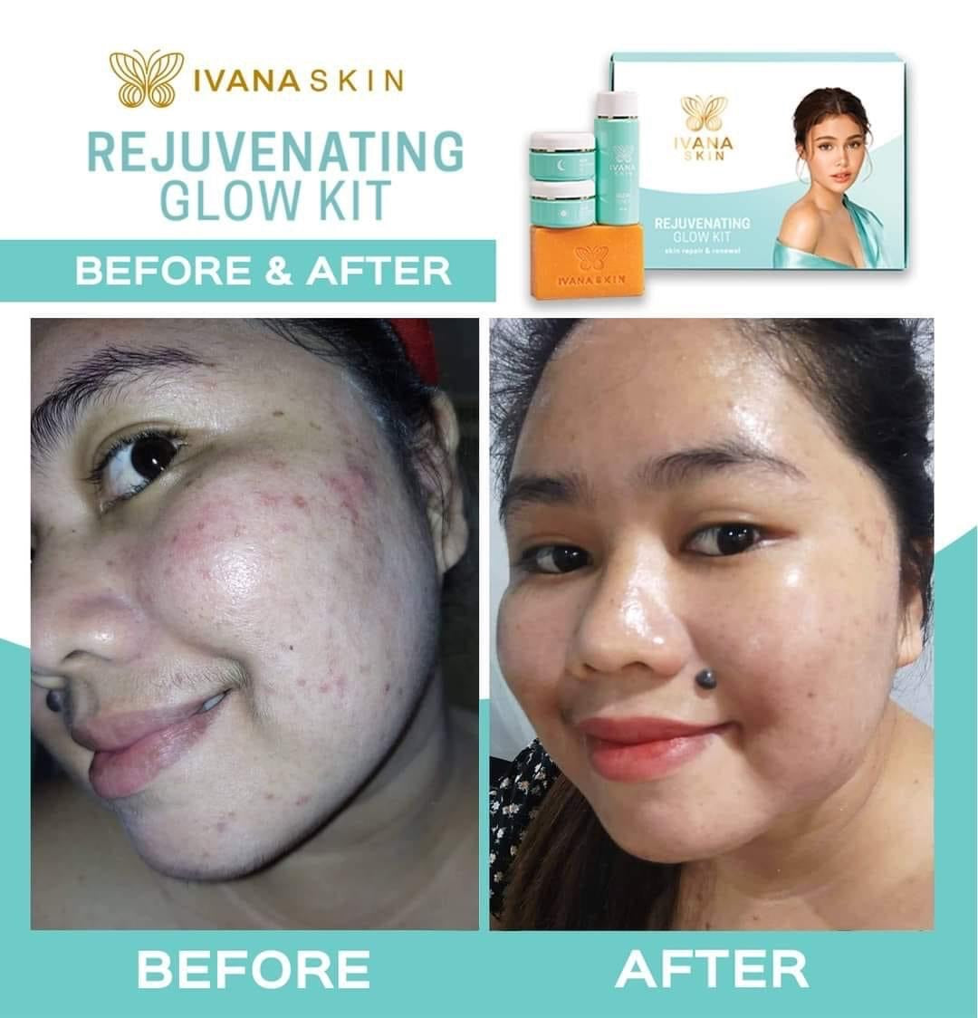 The Rejuvenating Glow Kit by Ivana Skin