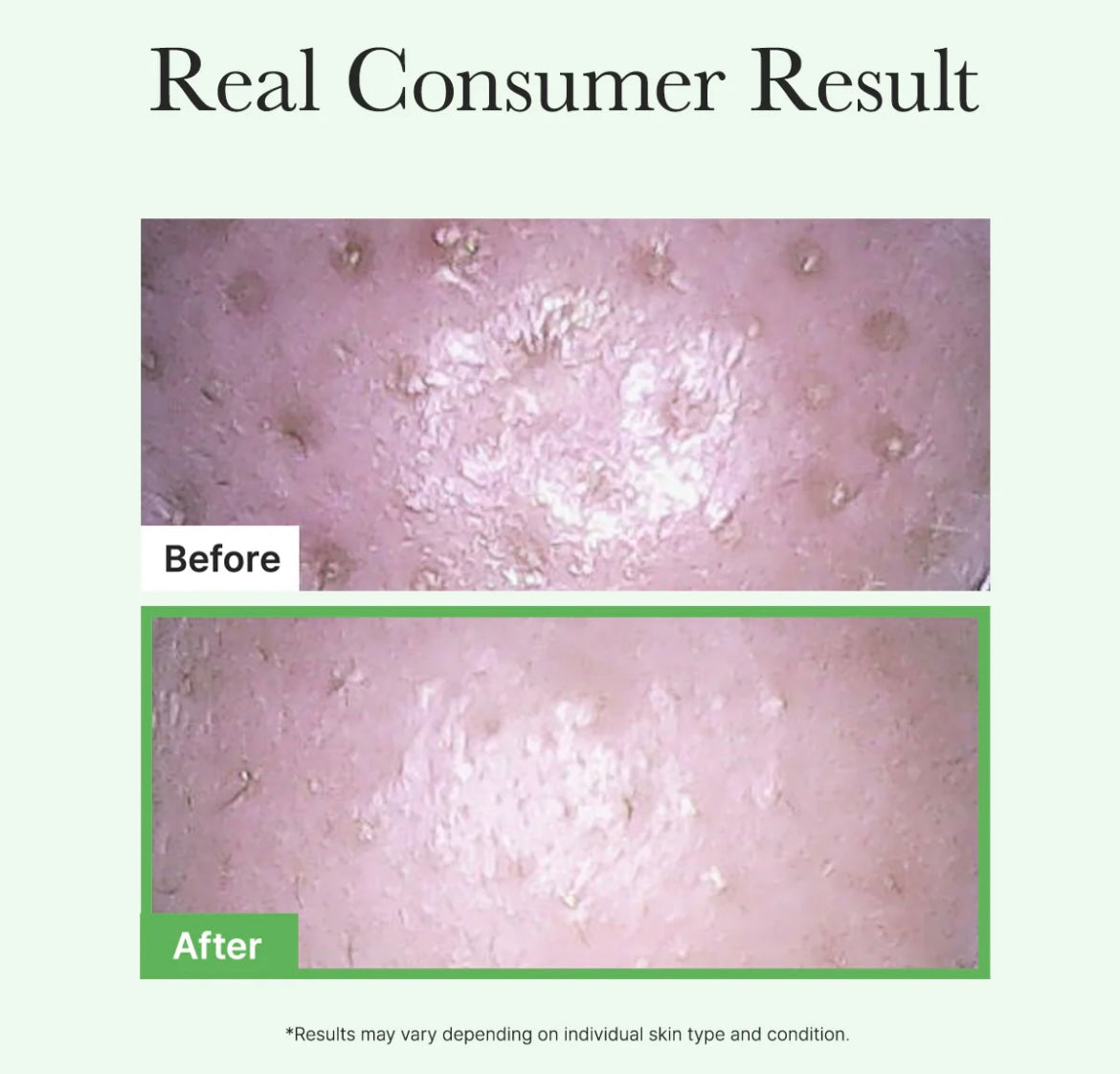 Arencia Pore Melt Mochi Cleansing Oil - 200ml