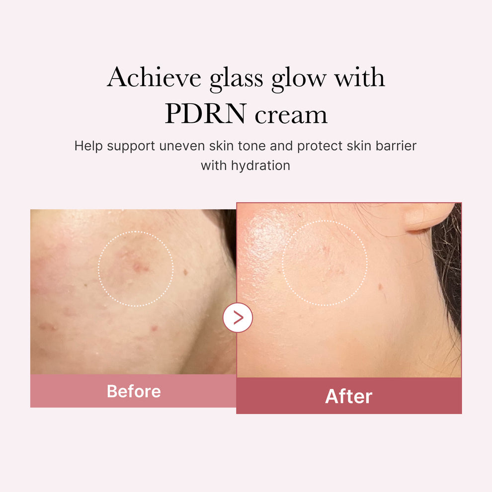 MEDICUBE PDRN Pink Hyaluronic Moisturizing Cream - 50ml