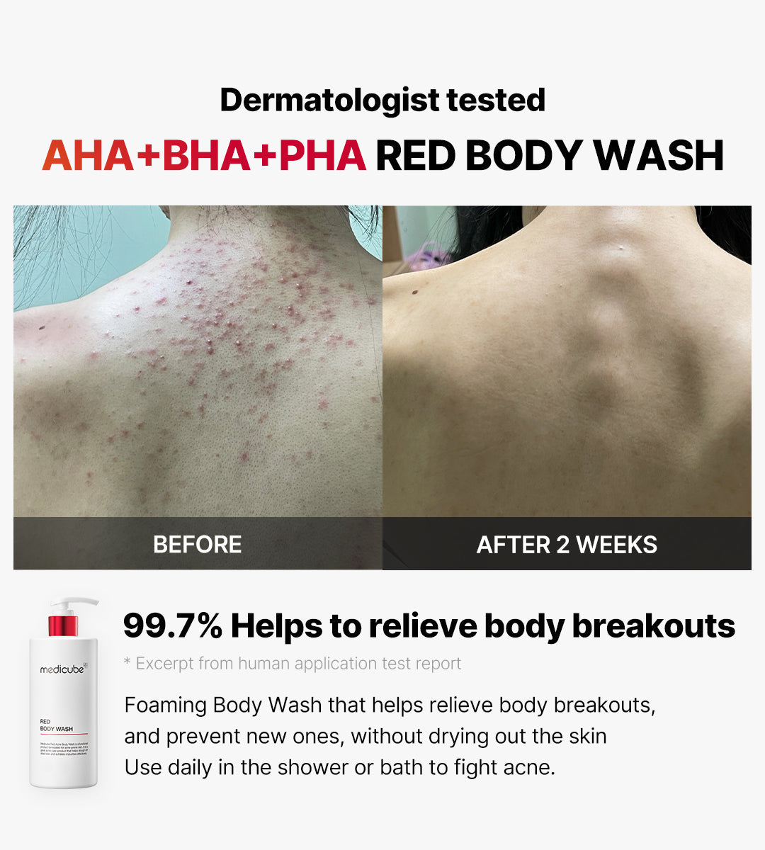 MEDICUBE Red Acne Body Wash - 400ml