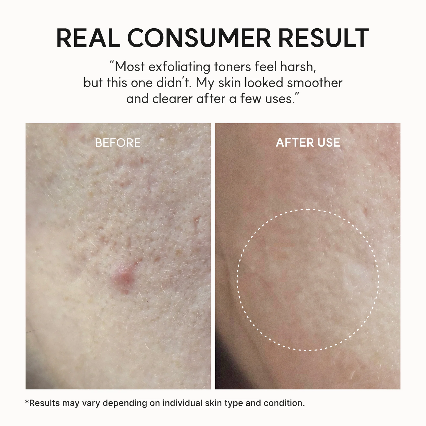 Arencia Erasor Shot Glycolic Acid Exfoliator - 200ml