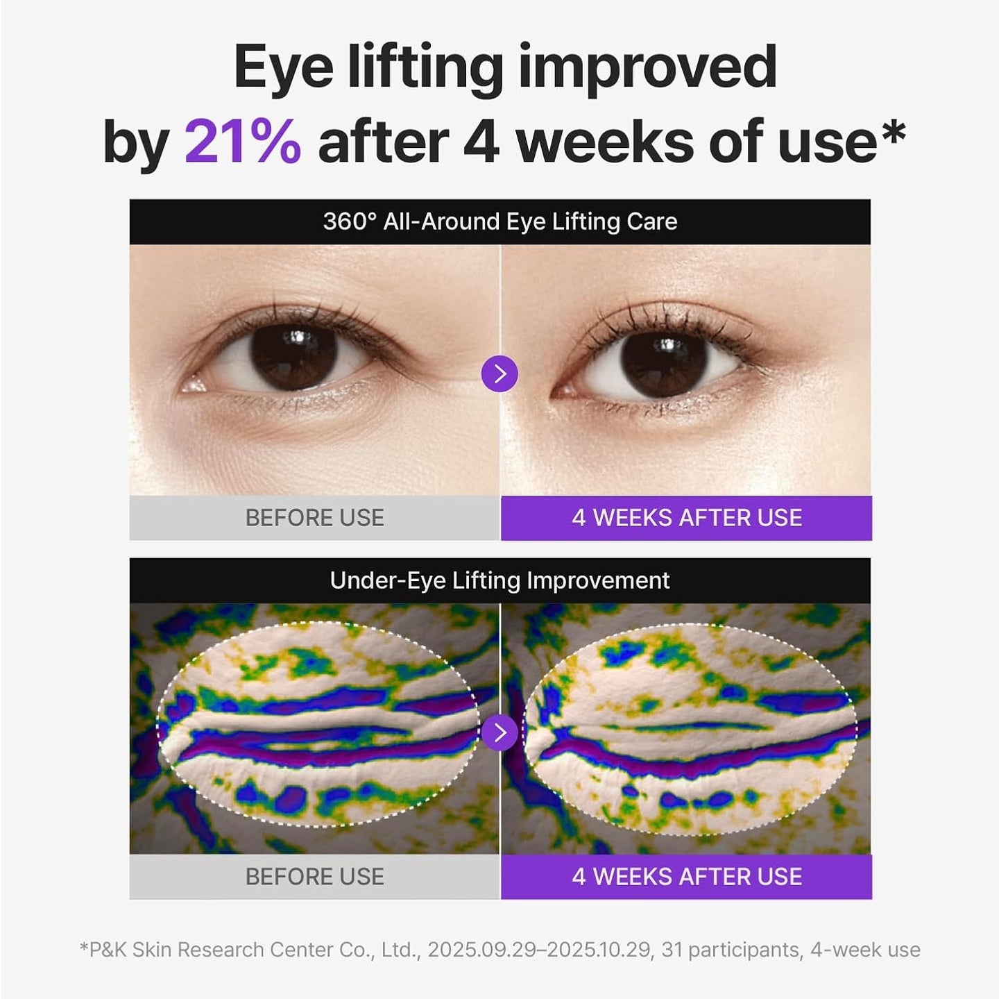 Centellian 24 360 Shot PDRN Lifting Eye Cream - 50ml