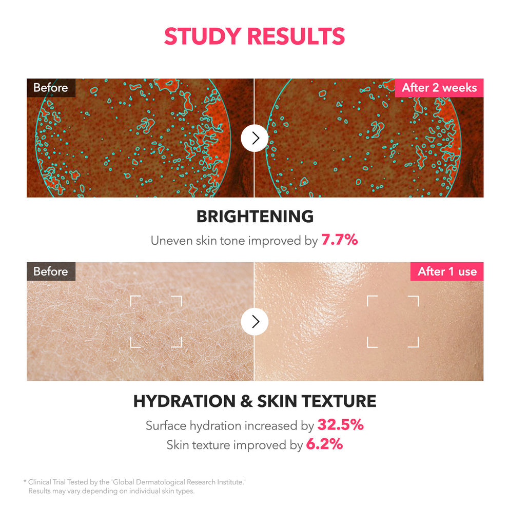 APRIL SKIN TXA+Niacinamide 99 Pink Milky Toner - 150ml