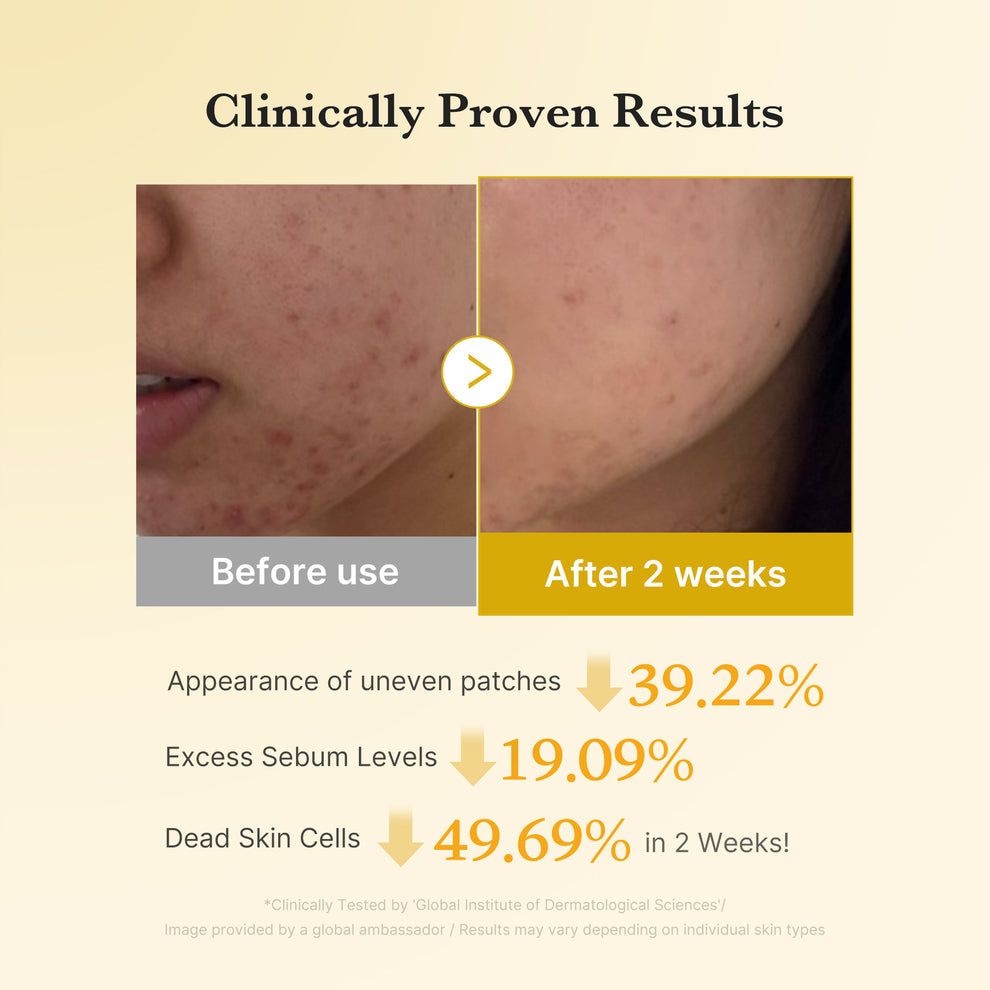 MEDICUBE Kojic Acid Turmeric Toner Pad - 160ml