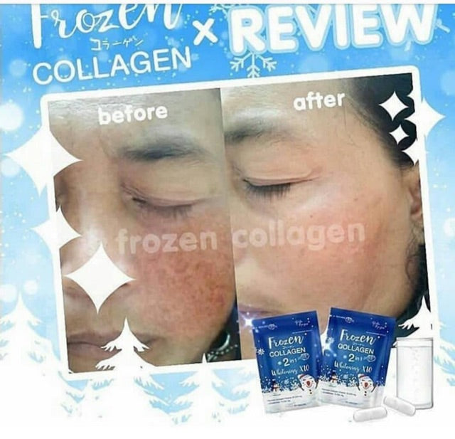 Gluta Frozen - Frozen Collagen 2 in 1 Whitening Supplement (×60 Capsules)